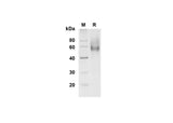 SDS-PAGE analysis of Mouse L-Selectin/CD62L proteins , 2 μg/lane of Recombinant Mouse L-Selectin/CD62L proteins was resolved with SDS-PAGE under reducing conditions , showing bands at 55-60 kDa.