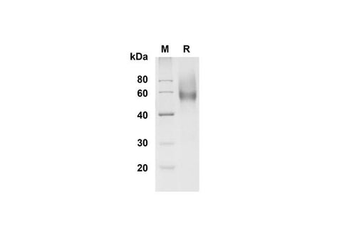 SDS-PAGE analysis of Mouse L-Selectin/CD62L proteins , 2 μg/lane of Recombinant Mouse L-Selectin/CD62L proteins was resolved with SDS-PAGE under reducing conditions , showing bands at 55-60 kDa.