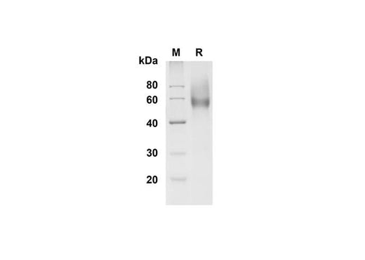 SDS-PAGE analysis of Mouse L-Selectin/CD62L proteins , 2 μg/lane of Recombinant Mouse L-Selectin/CD62L proteins was resolved with SDS-PAGE under reducing conditions , showing bands at 55-60 kDa.
