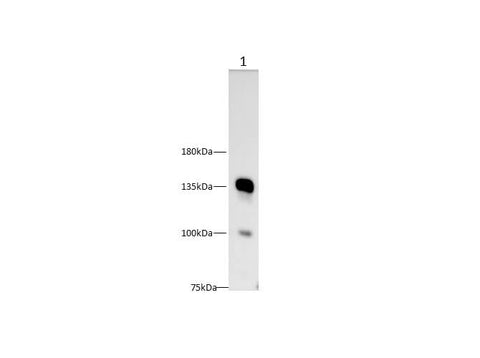 Anti-Human CD22 Antibody - ABMIUM