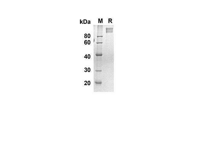 SDS-PAGE analysis of Human MAG proteins, 2 μg/lane of Recombinant Human MAG proteins was resolved with SDS-PAGE under reducing conditions, showing bands at 79.5 kDa.