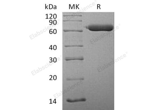 Recombinant Human SGSH Protein (His Tag) - ABMIUM