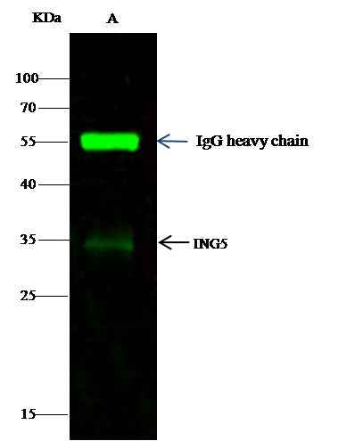 Anti-Human ING5 Antibody [B192] - ABMIUM
