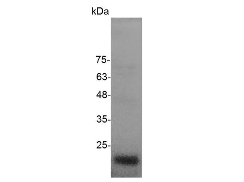 > 98 % as determined by reducing SDS-PAGE.