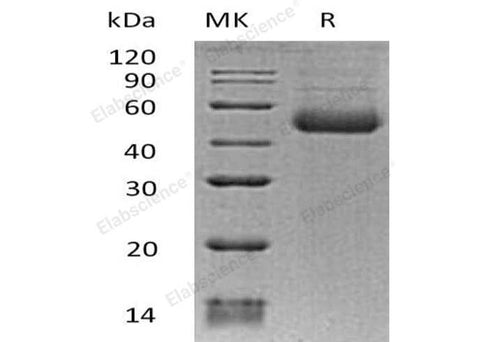 Recombinant Human ST8SIA1 Protein (His Tag) - ABMIUM