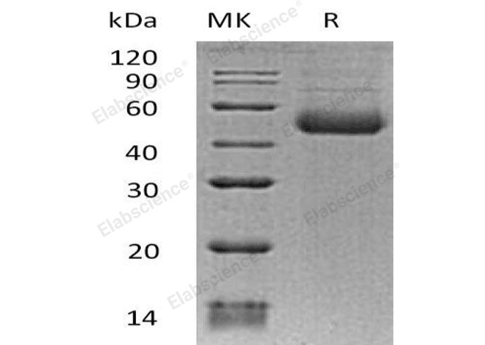 Recombinant Human ST8SIA1 Protein (His Tag) - ABMIUM
