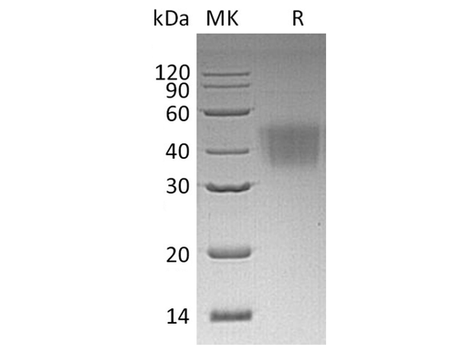 Recombinant Human CD16a/FCGR3A Protein (His Tag) - ABMIUM