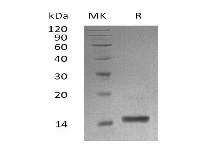 Recombinant Human α-Lactalbumin/LALBA Protein (His Tag) - ABMIUM