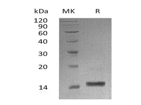 Recombinant Human α-Lactalbumin/LALBA Protein (His Tag) - ABMIUM