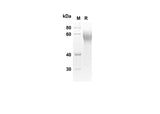 SDS-PAGE analysis of Human CRTAM proteins, 2 μg/lane of Recombinant Human CRTAM proteins was resolved with SDS-PAGE under reducing conditions, showing bands at 29.5 kDa.