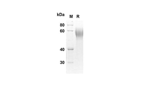 SDS-PAGE analysis of Human CRTAM proteins, 2 μg/lane of Recombinant Human CRTAM proteins was resolved with SDS-PAGE under reducing conditions, showing bands at 29.5 kDa.