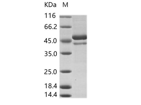 Recombinant DENV (type 4, strain Philippines/H241/1956) E / Envelope Protein (ECD, His Tag) - ABMIUM