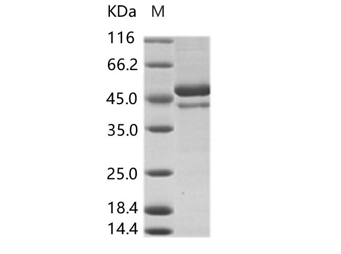 Recombinant DENV (type 4, strain Philippines/H241/1956) E / Envelope Protein (ECD, His Tag) - ABMIUM