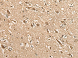 Immunohistochemistry of paraffin-embedded Human brain tissue using BATF Polyclonal Antibody at dilution of 1:45(×200)