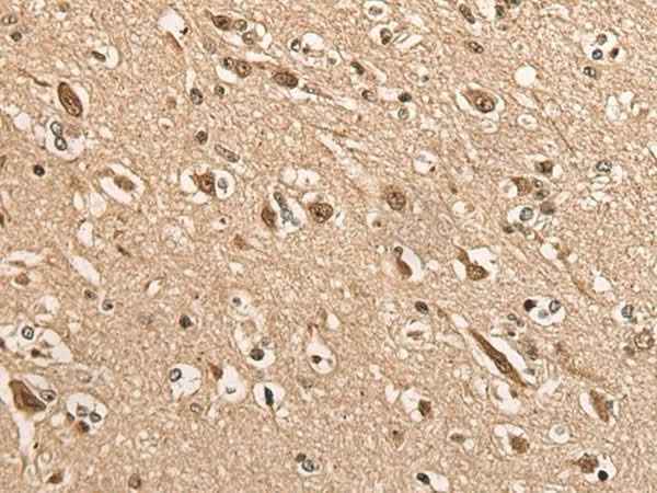 Anti-Human/Mouse/Rat BATF Antibody