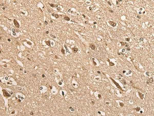 Anti-Human/Mouse/Rat BATF Antibody