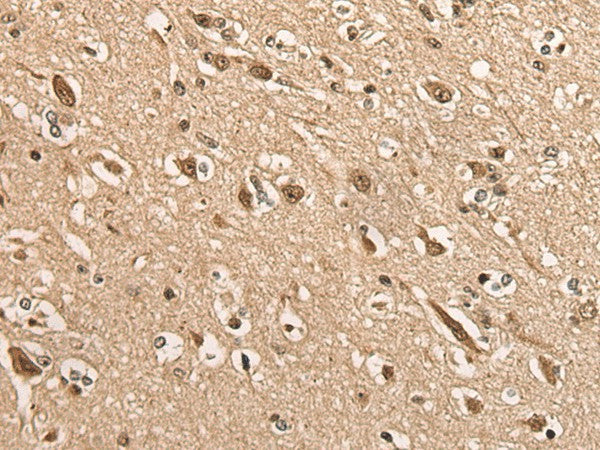 Immunohistochemistry of paraffin-embedded Human brain tissue using BATF Polyclonal Antibody at dilution of 1:45(×200)