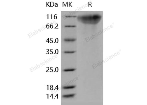 Recombinant Human OMGP/OMG Protein (aa 1-420, His Tag) - ABMIUM