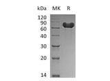 Recombinant Human GOLPH2/GOLM1 Protein (aa 36-401, His Tag) - ABMIUM