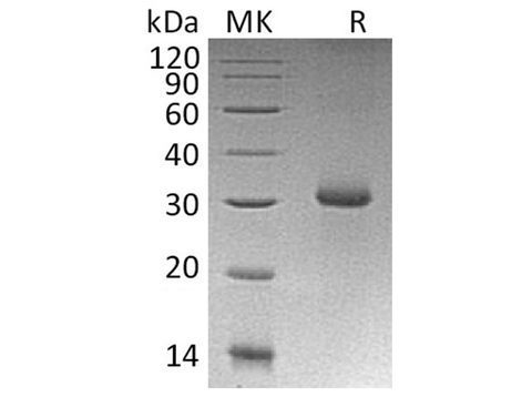 Recombinant Human RGMA Protein (E.coli, His Tag) - ABMIUM