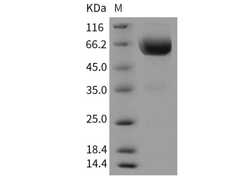 Recombinant Mouse TIM-3/HAVCR2 Protein (Fc Tag) - ABMIUM