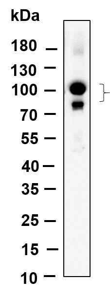 Anti-Human/Mouse/Rat CUL4A/B Antibody [B939] - ABMIUM