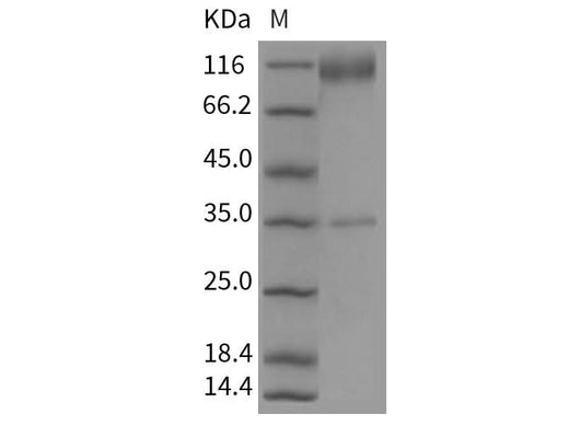 > 80 % as determined by reducing SDS-PAGE.