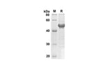 SDS-PAGE analysis of Human CDH1 proteins, 2 μg/lane of Recombinant Human CDH1 proteins was resolved with SDS-PAGE under reducing conditions, showing bands at 40.3 kDa.