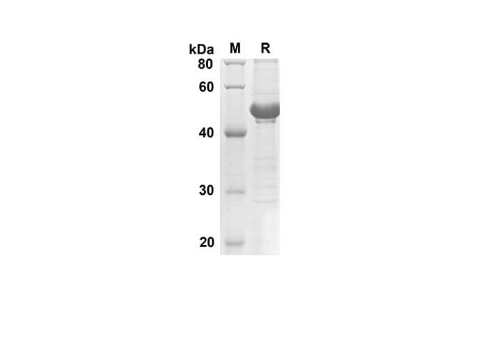SDS-PAGE analysis of Human CDH1 proteins, 2 μg/lane of Recombinant Human CDH1 proteins was resolved with SDS-PAGE under reducing conditions, showing bands at 40.3 kDa.