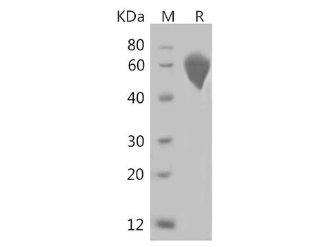 SDS-PAGE analysis of Rat Syndecan-1/SDC1 proteins, 2 μg/lane of Recombinant Rat Syndecan-1/SDC1 proteins was resolved with SDS-PAGE under reducing conditions, showing bands at 47 & 49 kDa.