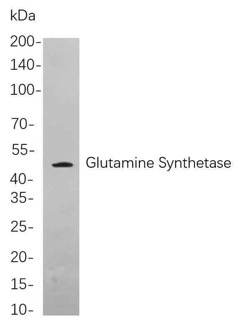 Anti-Human/Mouse/Rat Glutamine Synthetase Antibody [B737] - ABMIUM