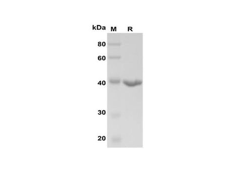 SDS-PAGE analysis of Human CCL17 proteins, 2 μg/lane of Recombinant Human CCL17 proteins was resolved with SDS-PAGE under reducing conditions, showing bands at 40 kDa.