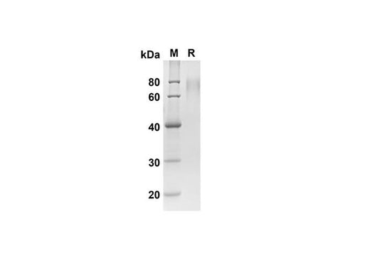 SDS-PAGE analysis of Mouse CD6 proteins, 2 μg/lane of Recombinant Mouse CD6 proteins was resolved with SDS-PAGE under reducing conditions, showing bands at 41.9 kDa.