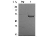 Recombinant Human ALDH1A3 Protein (His Tag) - ABMIUM