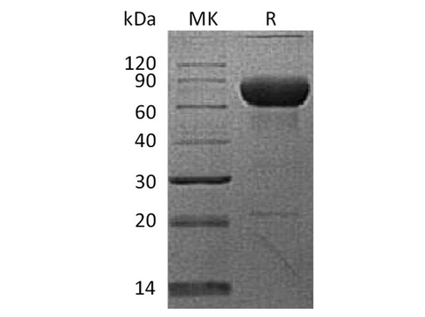 Recombinant Cynomolgus PD-L2/B7-DC/CD273 Protein (Fc Tag) - ABMIUM