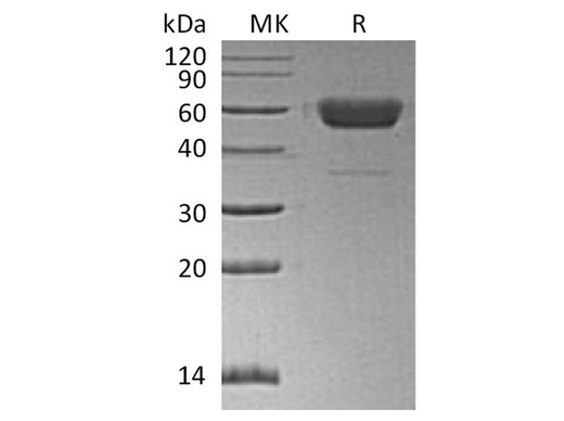 Recombinant Human/Mouse/Rat Irisin/FNDC5 Protein (Fc Tag) - ABMIUM