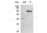 Recombinant Human PACSIN1/Syndapin-1 Protein (His Tag) - ABMIUM
