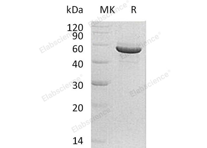 Recombinant Human PACSIN1/Syndapin-1 Protein (His Tag) - ABMIUM