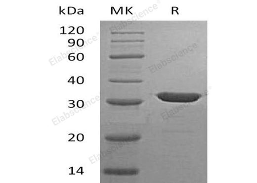 Recombinant Human Carbonic Anhydrase 13/CA13 Protein (His Tag) - ABMIUM