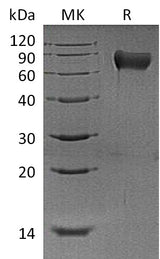 Recombinant Mouse Hemopexin/HPX Protein (His Tag) - ABMIUM