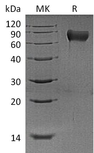 Recombinant Mouse Hemopexin/HPX Protein (His Tag) - ABMIUM