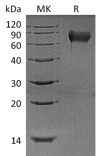 Recombinant Mouse Hemopexin/HPX Protein (His Tag) - ABMIUM