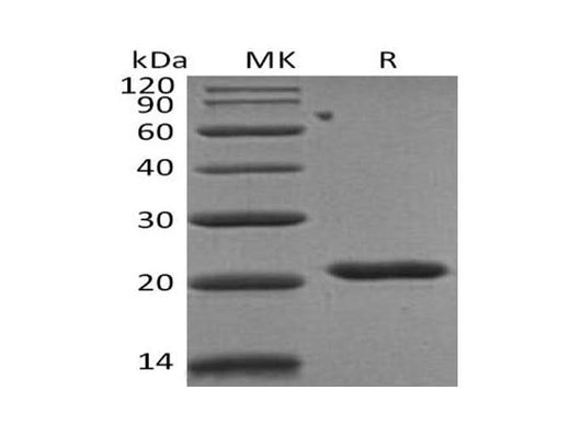 Recombinant Human TIMP2/TIMP-2 Protein (His Tag) - ABMIUM