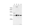 Anti-Human/Mouse/Rat CCND1 Antibody - ABMIUM