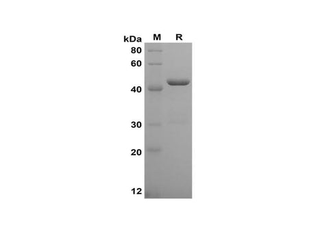 SDS-PAGE analysis of Human TNF-α proteins, 2 μg/lane of Recombinant Human TNF-α proteins was resolved with SDS-PAGE under reducing conditions, showing bands at 45 kDa.