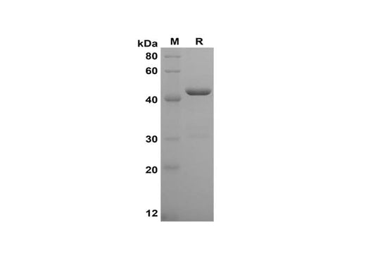 SDS-PAGE analysis of Human TNF-α proteins, 2 μg/lane of Recombinant Human TNF-α proteins was resolved with SDS-PAGE under reducing conditions, showing bands at 45 kDa.