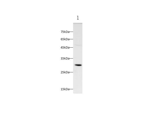 Anti-Mouse TIMP1 Antibody - ABMIUM