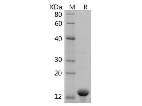 SDS-PAGE analysis of Human Parvalbumin Alpha/PVALB proteins, 2 μg/lane of Recombinant Human Parvalbumin Alpha/PVALB proteins was resolved with SDS-PAGE under reducing conditions, showing bands at 14 kDa.