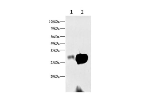 Anti-Mouse/Rat STAR Antibody - ABMIUM
