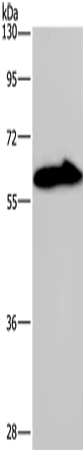 Anti-Human/Mouse KCNG4 Antibody - ABMIUM